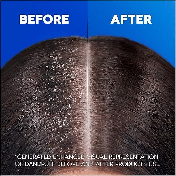 Head & Shoulders Apple Fresh Anti Dandruff Shampoo, 1000ml - Image 4