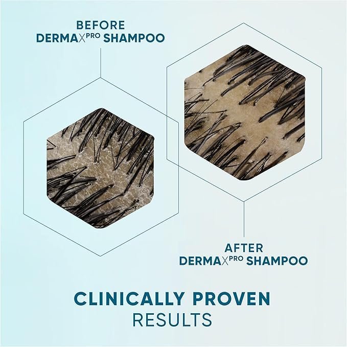 Head & Shoulders Anti-dandruff Shampoo, DermaXPRO | Helps Support Hair Growth, 300ml - Image 3